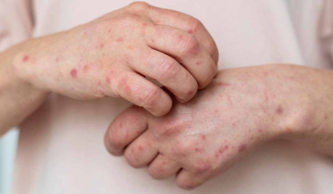 Viridis is dermatologically proven for use on sensitive skin